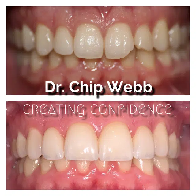 general dentistry orthodontics do good dental smile gallery image 01
