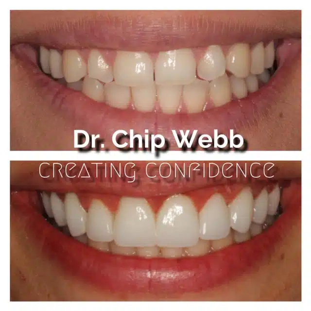 general dentistry orthodontics do good dental smile gallery image 03