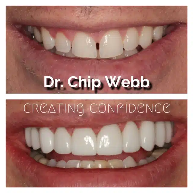 general dentistry orthodontics do good dental smile gallery image 12