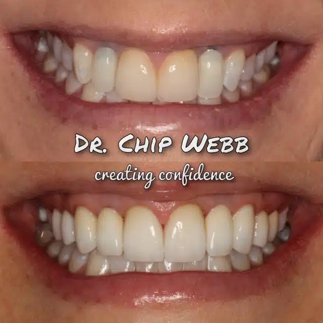 general dentistry orthodontics do good dental smile gallery image 14