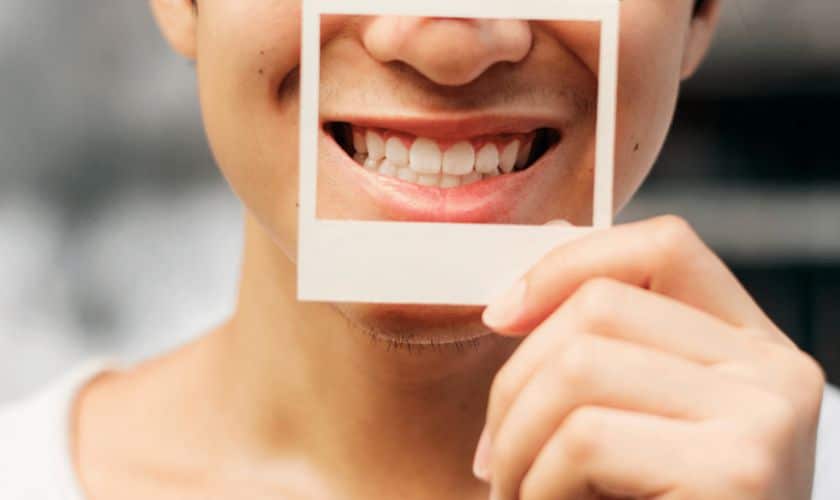 Do Teeth Whitening Weaken the Enamel on Your Teeth?