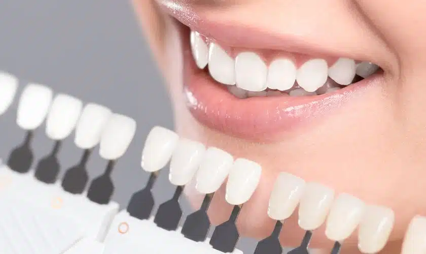 How Same-Day Crowns Are Reshaping the Future of Dentistry