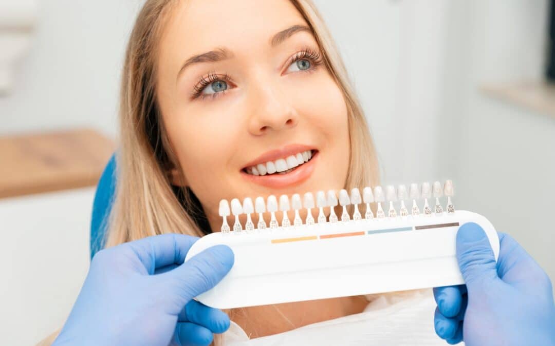 Keeping Smile Brighter: How Long Does Teeth Whitening in Tempe Last